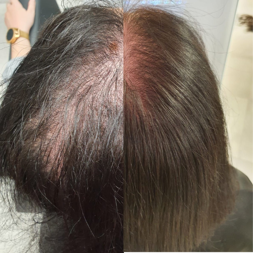 Scalp Care-Shampoo – für normale & trockene Kopfhaut
